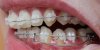 Tag 43_Hebel UK.JPG