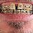 Braces##